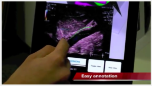 Read more about the article Augmented reality for medical imaging